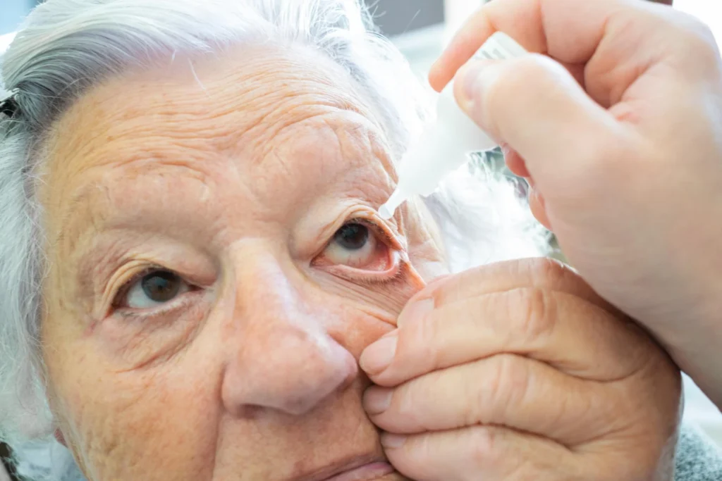 Cataract Management and Treatment: A Complete Guideline