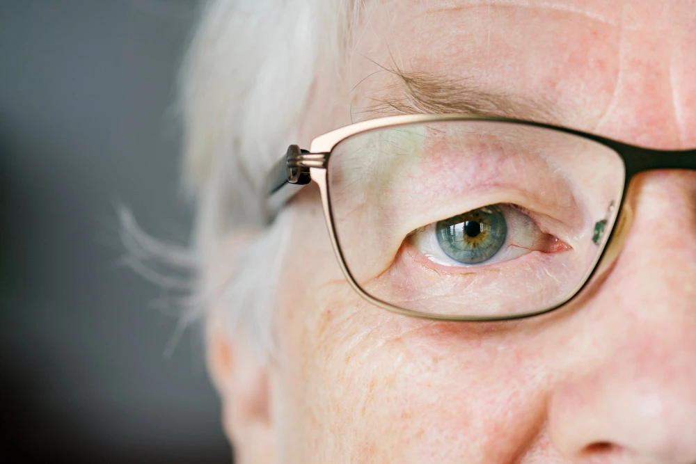 What is Age-related Macular Degeneration?