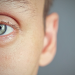 Dry Eyes in Winter: Causes, Treatment, and Prevention