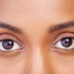 Eye Problems with Thyroid: Causes,Symptoms and Treatment