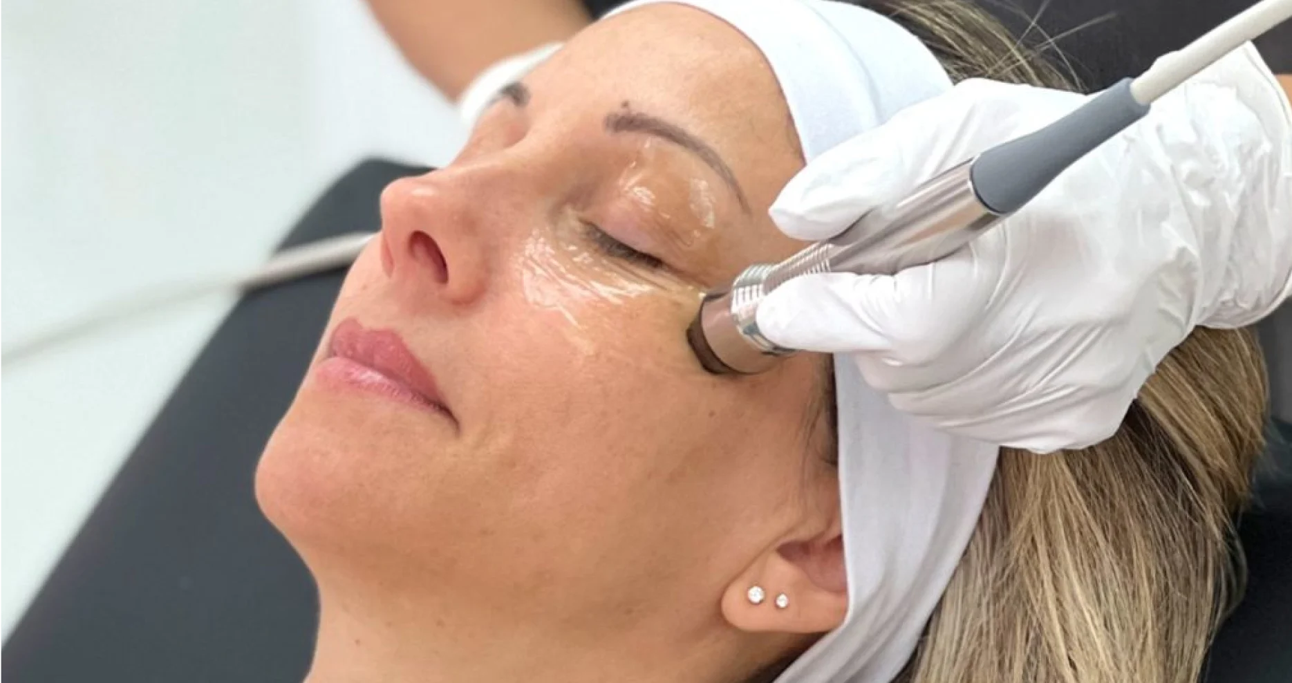 Dry Eyes Specialist in Katy, TX